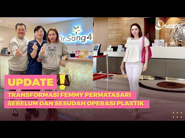 Transformasi Femmy Permatasari Sebelum dan Sesudah Operasi Plastik