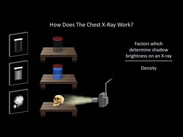 How to Interpret a Chest X-Ray (Lesson 1 - An Introduction)