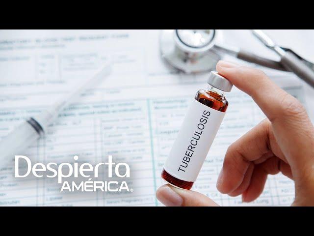 Medicamento para la tuberculosis posiblemente podría atacar el covid-19 | Dr. Juan