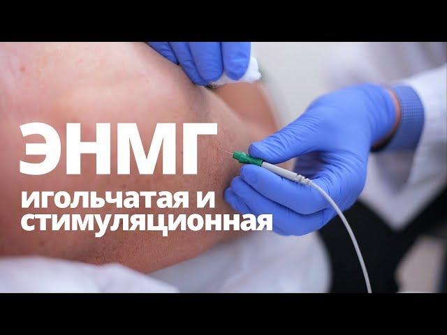 ЭНМГ - основные методики. Что показывает миография? Когда назначается?