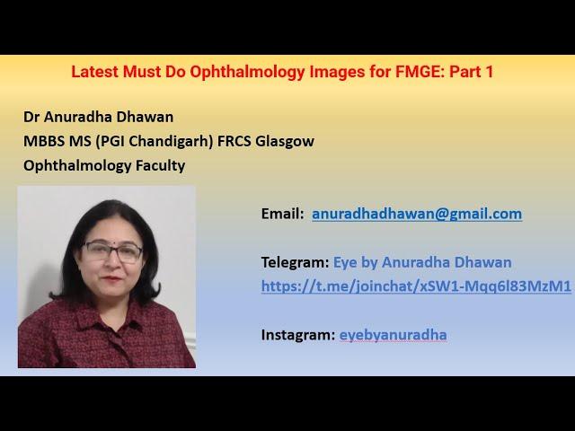 Latest Must Do Ophthalmology Images for FMGE: Part 1