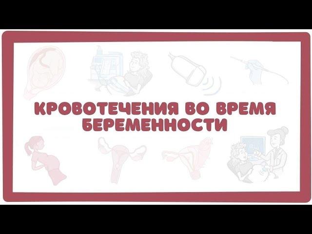 Кровотечения при беременности (акушерство гинекология лекции)