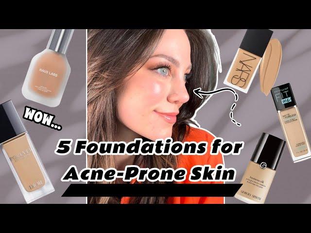 5 Non-Pore-Clogging Foundations for Acne-Prone Skin