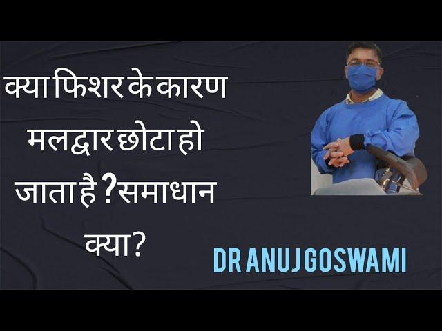 क्या फिशर के कारण मलद्वार छोटा हो जाता है? समाधान क्या?