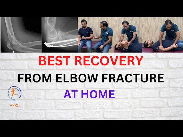 Rehabilitation & Exercises For Elbow Fracture Recovery | Exercises For Elbow  Stiffness Urdu| Hindi