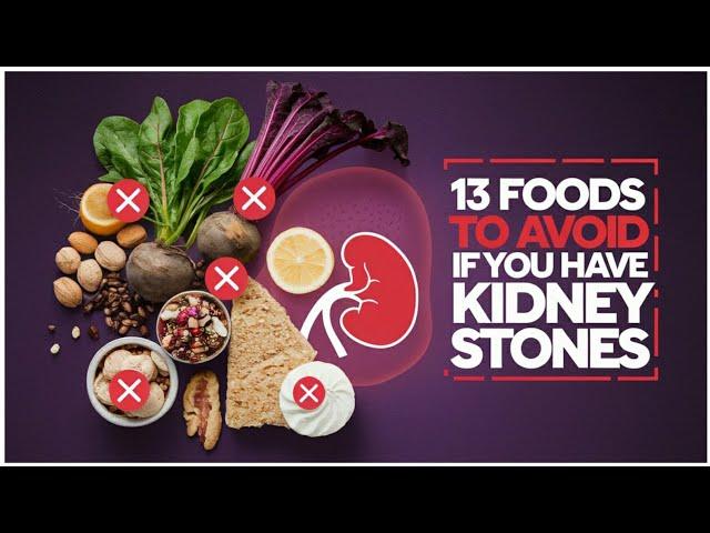 13 Foods to Avoid if You Have Kidney Stones