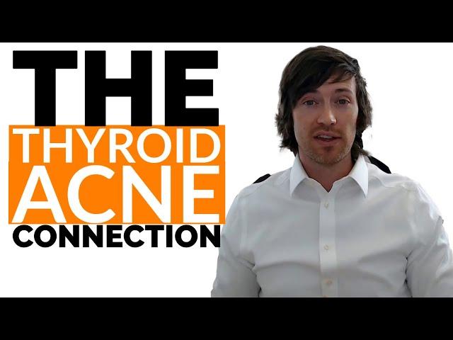 How Thyroid Problems Cause Acne (& How to Clear Your Skin)