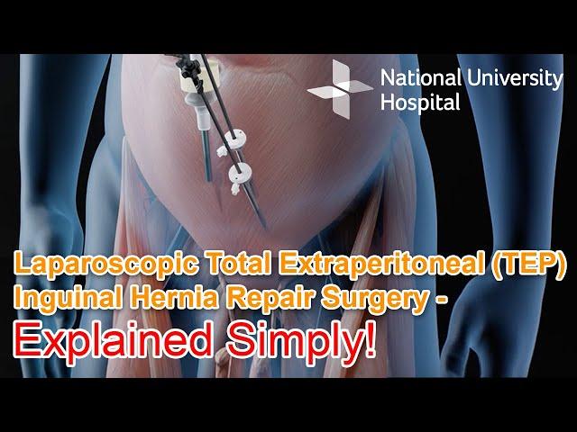 Laparoscopic Total Extraperitoneal (TEP) Inguinal Hernia Repair Surgery - Explained