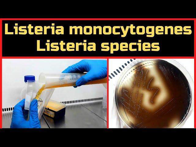 Detection of Listeria monocytogenes & Listeria species_Complete Procedure (ISO 11290-1 & BAM, Ch-10)