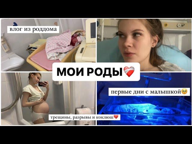 МОИ РОДЫ️‍🩹 Я РОДИЛА! ИСТОРИЯ МОИХ РОДОВ И ПЕРВЫЕ ДНИ С МАЛЫШКОЙ ПЦ КОНЧАЛОВСКОГО