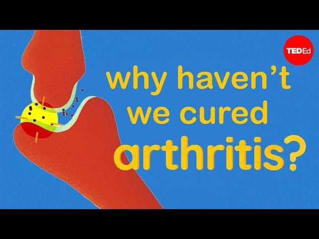 Why haven’t we cured arthritis? - Kaitlyn Sadtler and Heather J. Faust