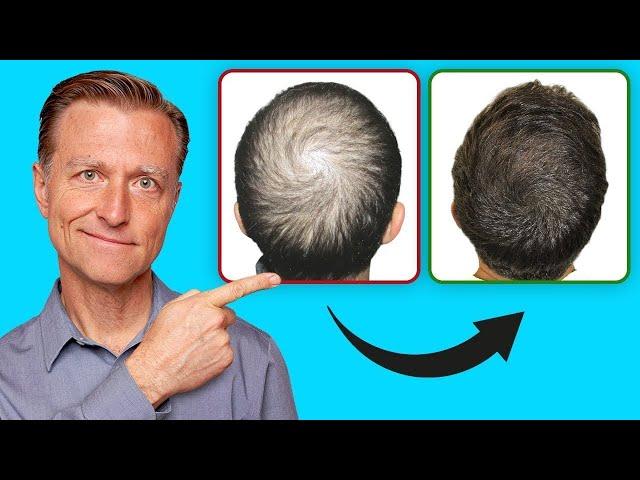Saçınızı Yeniden Nasıl Çıkarabilirsiniz (GÜNCEL ÖNEMLİ BİLGİLER) | Dr.Berg Türkçe