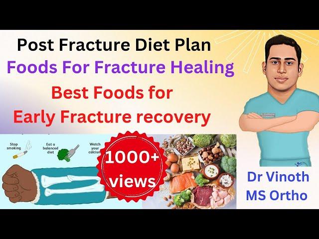 Fracture healing Foods|Post Fracture diet plan |Foods for Early fracture recovery|Bone healing foods