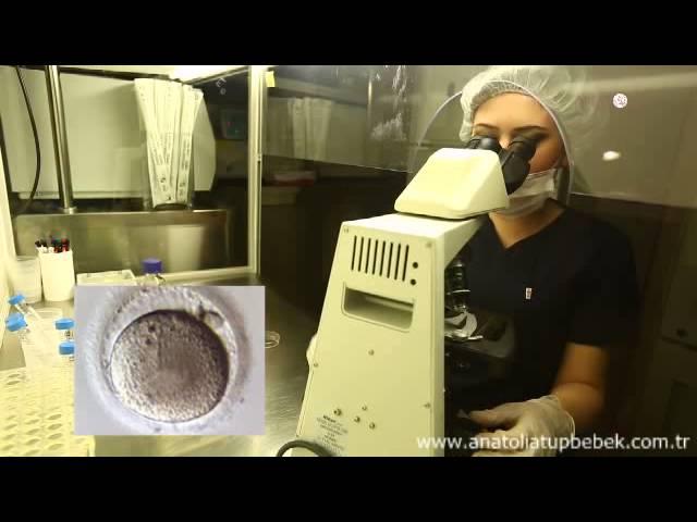 Tüp Bebek Tedavisinde Döllenme (Mikroenjeksiyon ile Döllenme) - Anatolia Tüp Bebek Merkezi