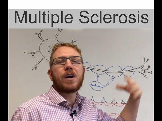 Multiple Sclerosis