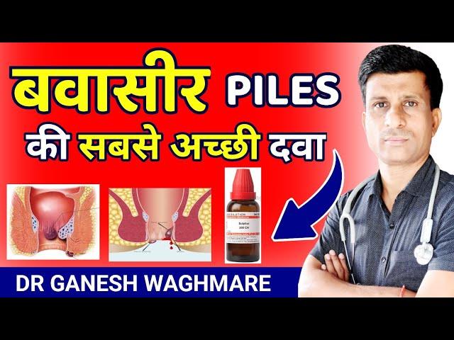 Bawasir Ka Ilaj | Piles Treatment At Home | Bawasir Ke Gharelu Upay