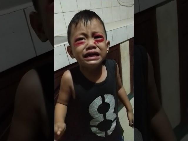 Umiyak ung anak ko  kasi dumugo yung Mata nya