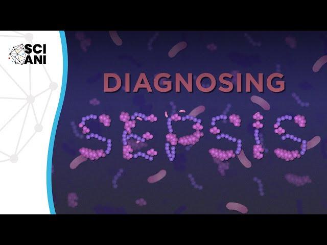 Diagnosing Sepsis