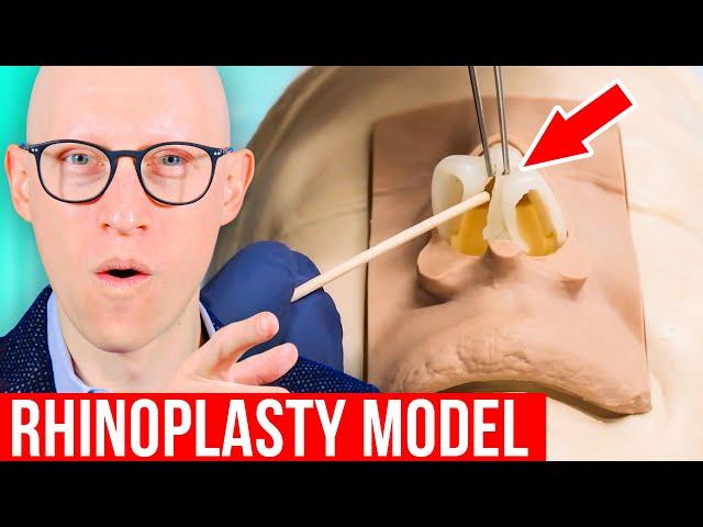 RHINOPLASTY Explained by Plastic Surgeon