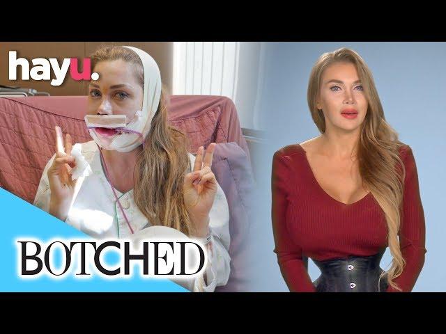 Pixee Wants To Be A 'Living Cartoon' | Season 5 | Botched