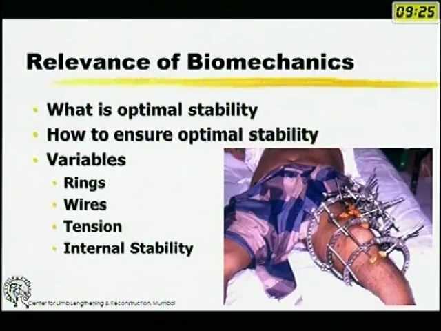 Biomechanics of Ilizarov Fixator