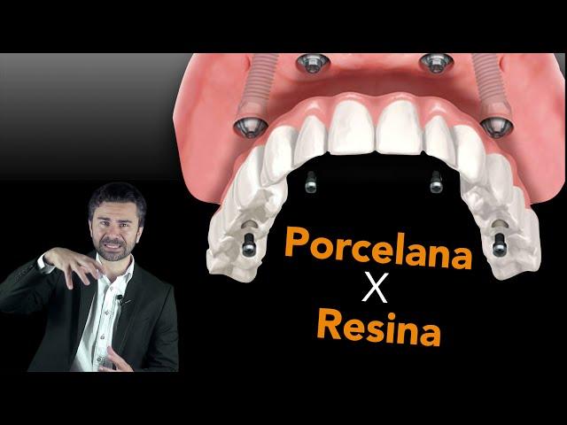 Implante Dentário Porcelana ou Resina?