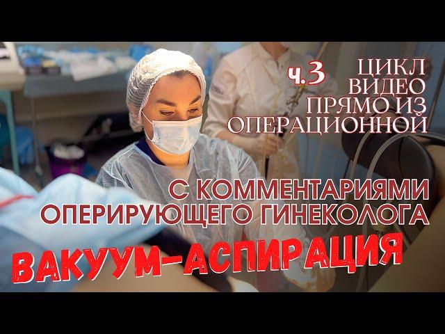 Вакуум-аспирация. Цикл видео из операционной, ч.3. Ника Спринг.