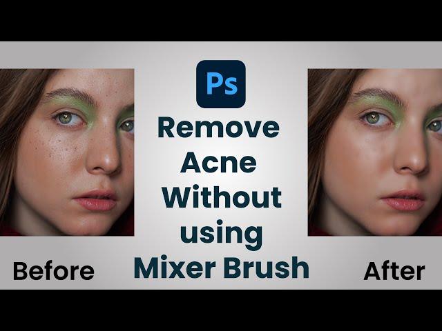 Remove Acne Without Using Mixer Brush Tool | Tips & Tricks| NextGen Graphics #acneremove #photoshop