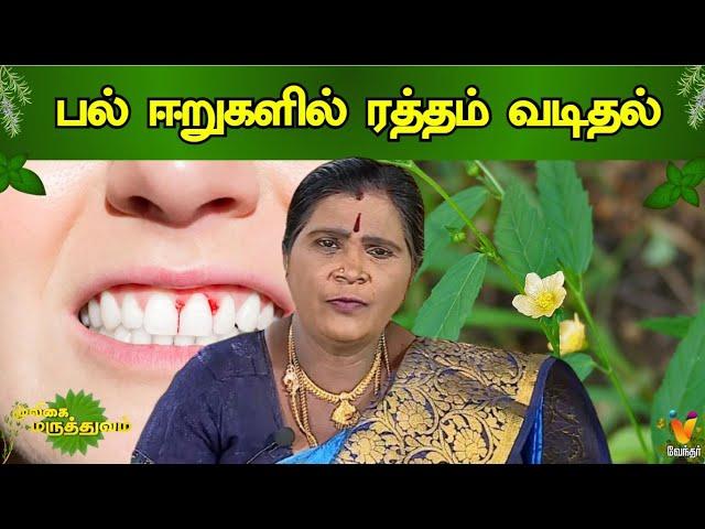 பல்  ஈறுகளில் ரத்தம் வடிதல் | Natural medicine for Gums bleeding | Mooligai Maruthuvam | Vendhar TV