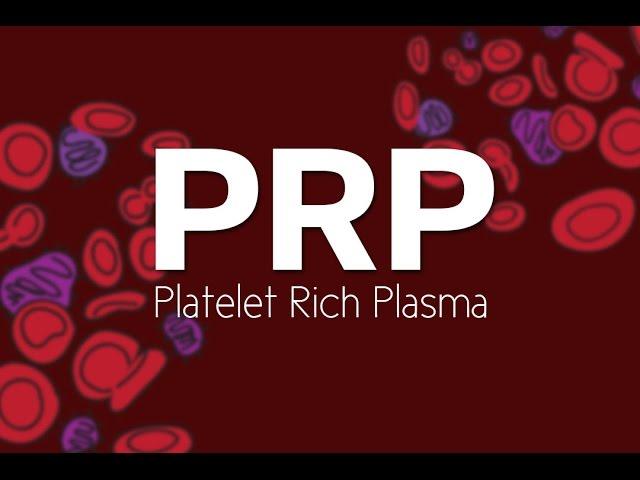 What is PRP (Platelet Rich Plasma)?