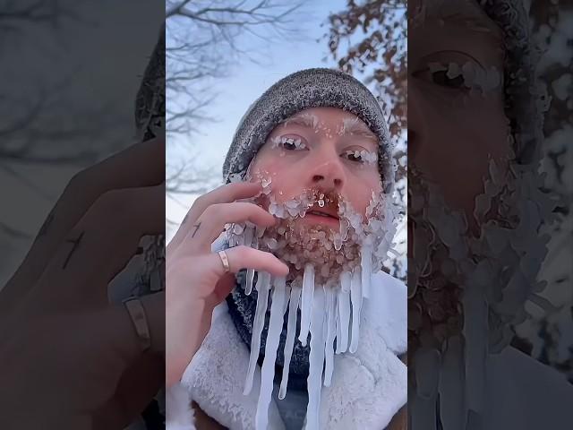 So cold  #funny #1million #shorts #snow #mostviralvideo #mostviewedonyoutube