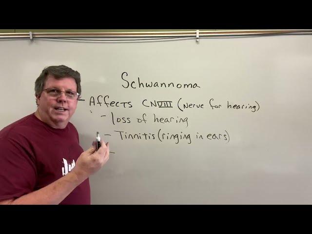 Schwannoma