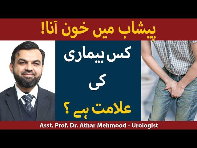Blood in Urine In Urdu/Hindi | Peshab Mein Khoon Aana | Peshab Mein  Khoon Ane Ka Ilaj