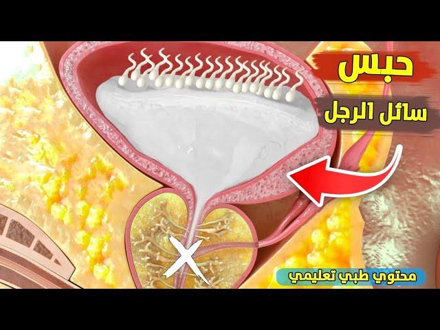 شاهد ما يحدث عند حبس سائل الرجل | محتوي طبي تثقيفي