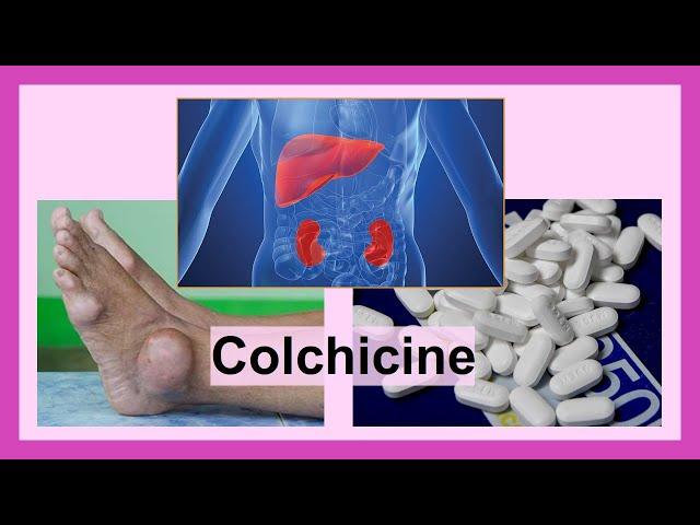 colchicine