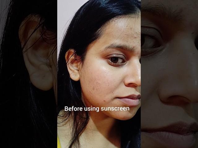 Before Vs After using sunscreen for a month #shorts #skincare #youtubeshorts #aqualogica