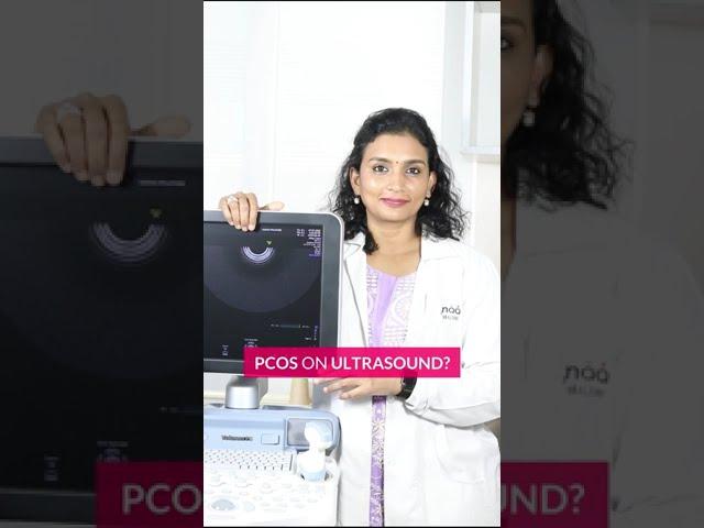 PCOS on Ultrasound? | Dr. Priya Kalyani