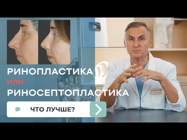 РИНОСЕПТОПЛАСТИКА  РИНОПЛАСТИКА  В ЧЕМ РАЗНИЦА? ЧТО ЛУЧШЕ?