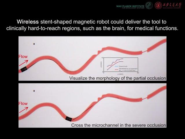 Soft Robotic Tool provides new 'eyes' in endovascular surgery