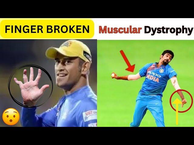 6 Big Cricketer Who are Physically disabled