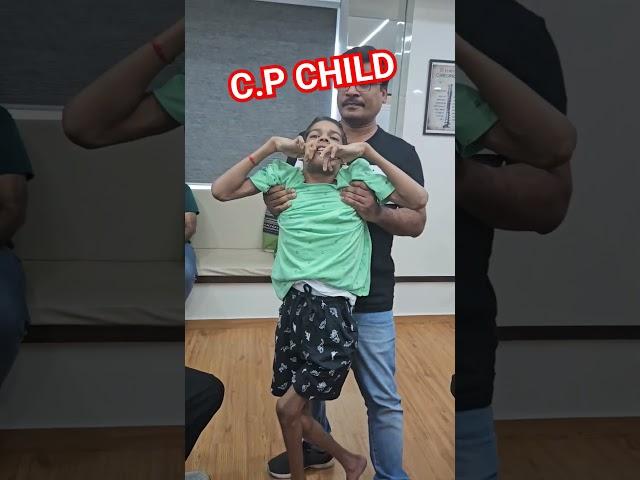 C.P child treatment by world famous Chiropractor Dr.Rajneesh kant