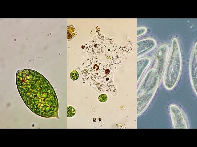 Microorganism moving methods - Flagella, Pseudopodia, and Cilia