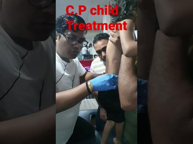 C.P child treatment