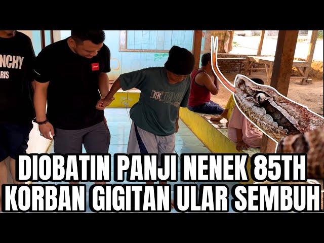 DITOLONG PANJI PETUALANG NENEK 85TH SELAMAT DARI GIGITAN ULAR VIPER