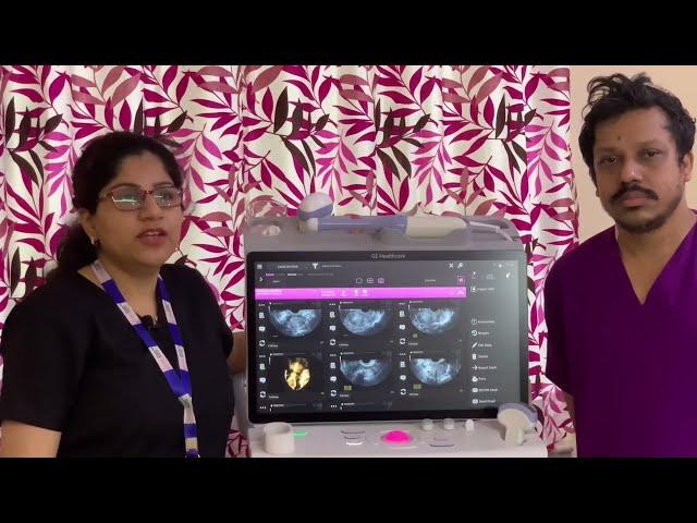 GE Voluson Swift USG -first Installation in Eastern India | Cradle Fertility Center