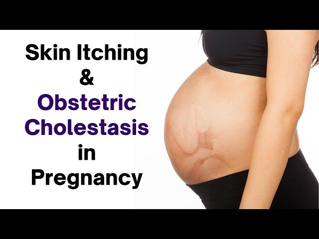 Pregnancy Itching? Discover Causes and Natural Relief Methods!