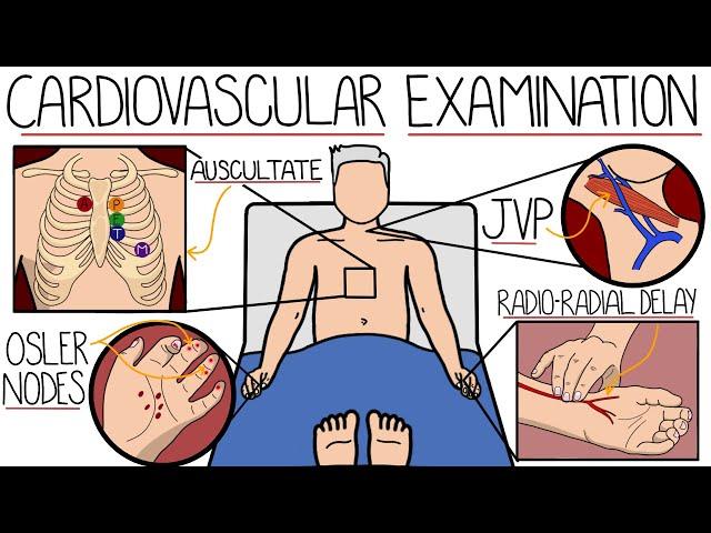 The Cardiovascular System Examination