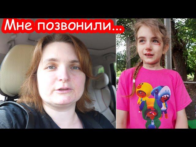 VLOG Разбила лицо в летнем лагере