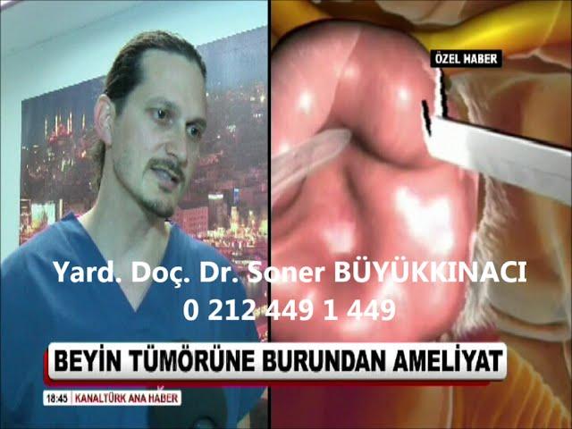 Burundan Beyin Tümörü Ameliyatı (Kanaltürk Ana Haber)