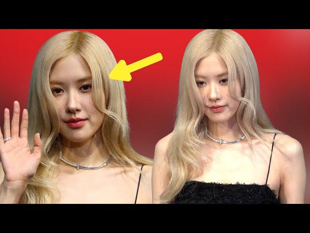 Rosé is suspected of having plastic surgery?